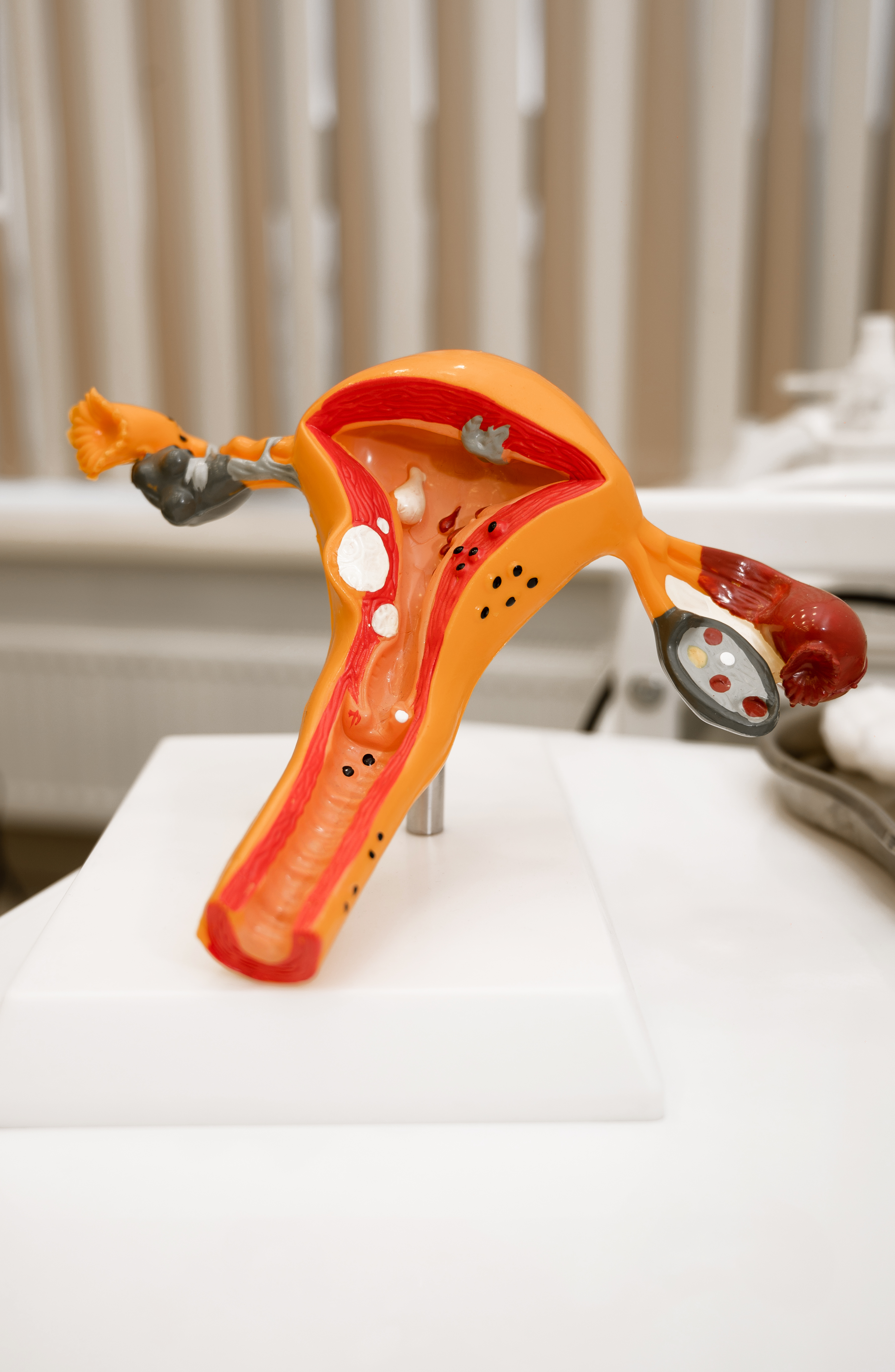 Биопсия шейки матки (радиоволновой метод)