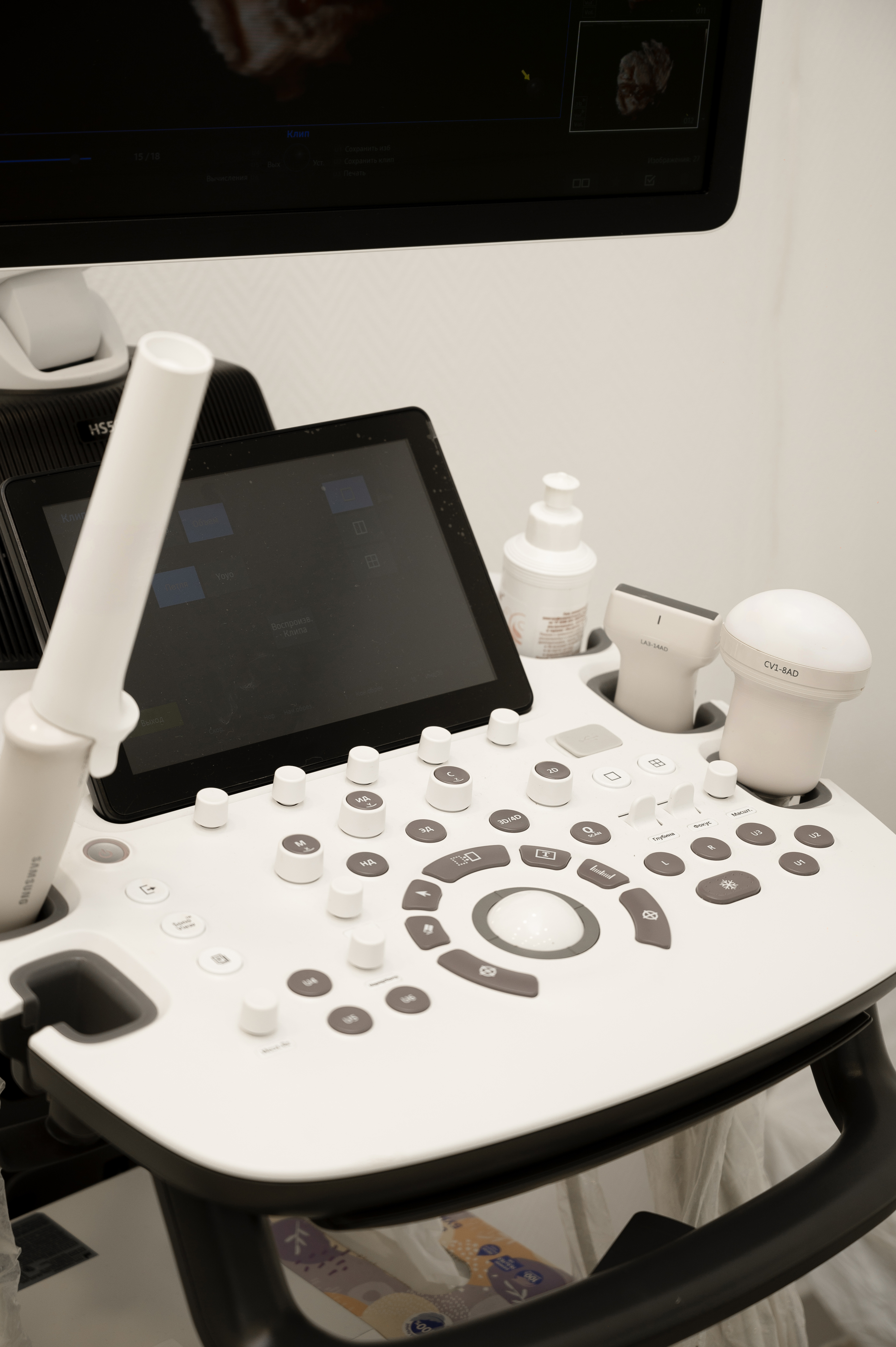 УЗИ молочных желез